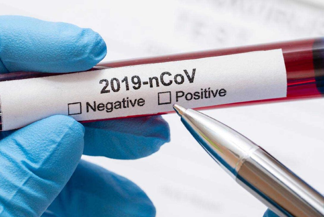 teste-novo-coronavirus-revista-nove
