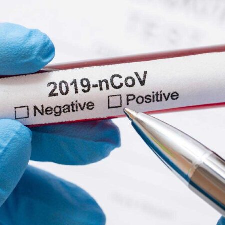 teste-novo-coronavirus-revista-nove